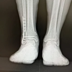 Radiografía de control postoperatorio tras cirugía de fractura de tobillo, con osteosíntesis mediante placa y tornillos. Imagen del Dr. Miguel Ángel Román Cañada en Sevilla.