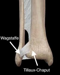 Vista anatómica del tubérculo de Tillaux-Chaput en la tibia y del tubérculo de Wagstaffe en el peroné, estructuras clave en la estabilidad del tobillo
